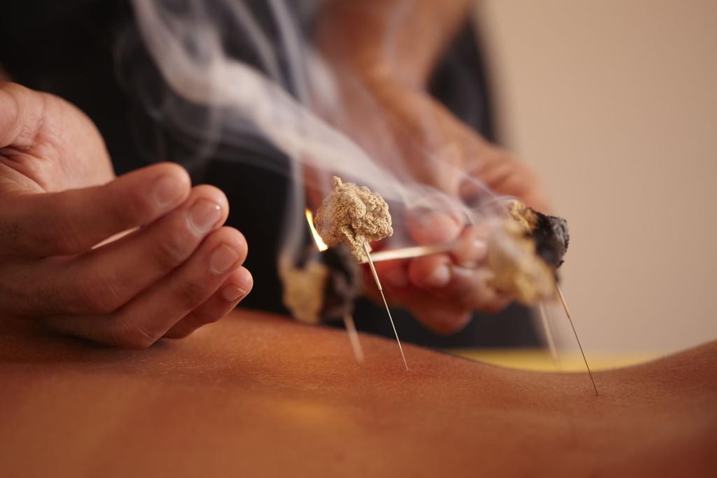 Hotel Alpino Atlantico Ayurveda Cure Centre - Adults Only Canico  Exterior photo